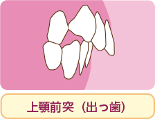 治療について 小児歯科