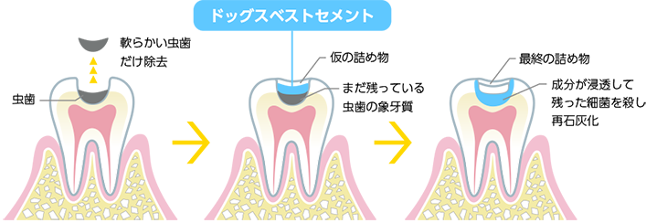 ドッグスベストセメント
