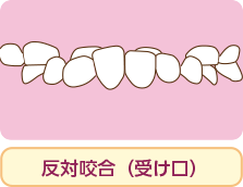 治療について 小児歯科